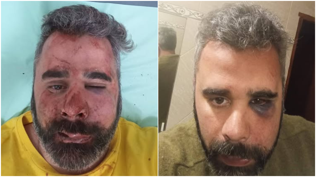 Brutal golpiza al titular del Partido Libertario