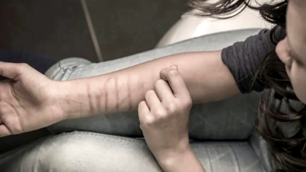 Salud Mental: detectar y abordar los cortes superficiales autoinfligidos